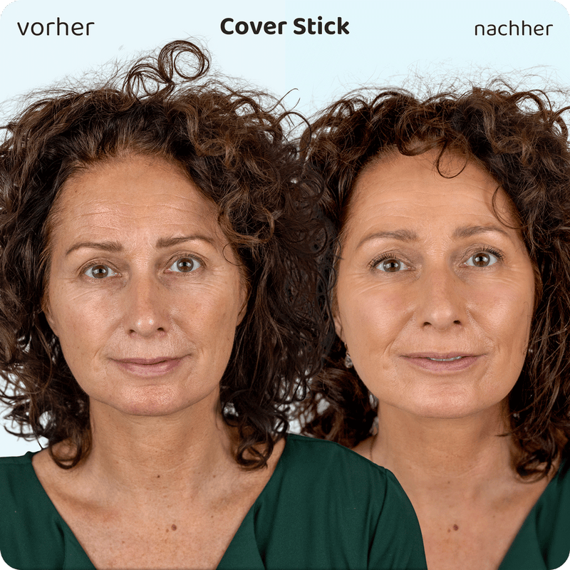 SkinMatch Cover Stift